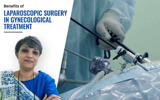 Laparoscopic Surgery