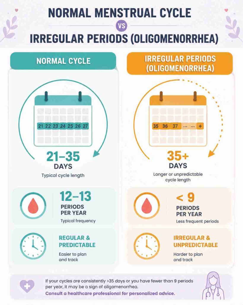 Medical infographic comparing a normal menstrual cycle with irregular periods (oligomenorrhea). The graphic shows a side-by-side comparison highlighting a normal cycle of 21–35 days with 12–13 periods per year versus oligomenorrhea with cycles longer than 35 days and fewer than 9 periods per year. Includes calendar, clock, and menstrual health icons in a clean flat vector design.