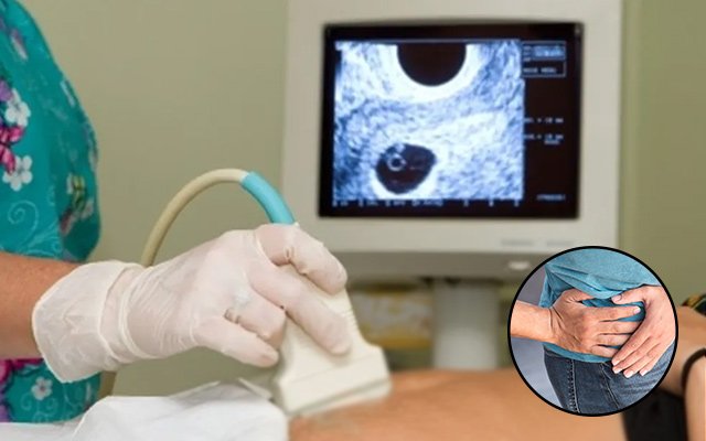 Pelvic ultrasound examination used to evaluate causes of pelvic pain in women